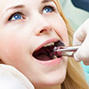 Как удалить зуб без боли в домашних условиях