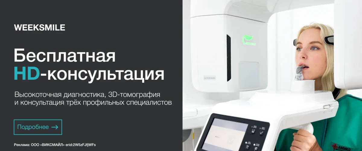 Виниры E-max