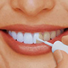 Как правильно сделать отбеливание зубов в домашних условиях 