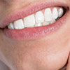 Как лечить кисту зуба дома: методы лечения и удаления