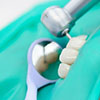 Методы лечения каналов зуба