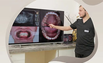 Имплант AB Dental