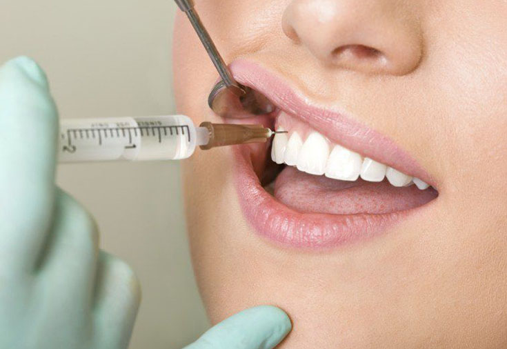 безболезненное удаление зуба