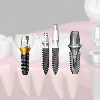 Импланты Дентиум (Dentium): виды корейских имплантов, показания, преимущества